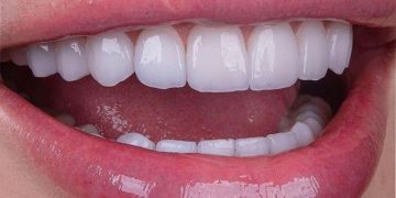 روش‌های زیبایی دندان