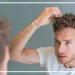 علت چرب شدن موی سر مردان