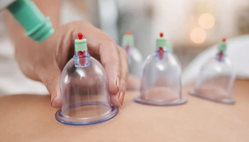 مزایا و عوارض حجامت